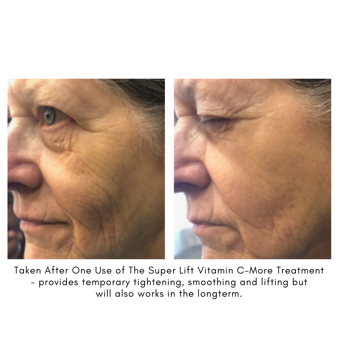 Maya Chia The Super Lift Vitamin C Results