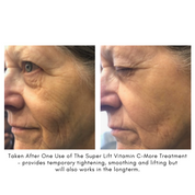 Maya Chia The Super Lift Vitamin C Results