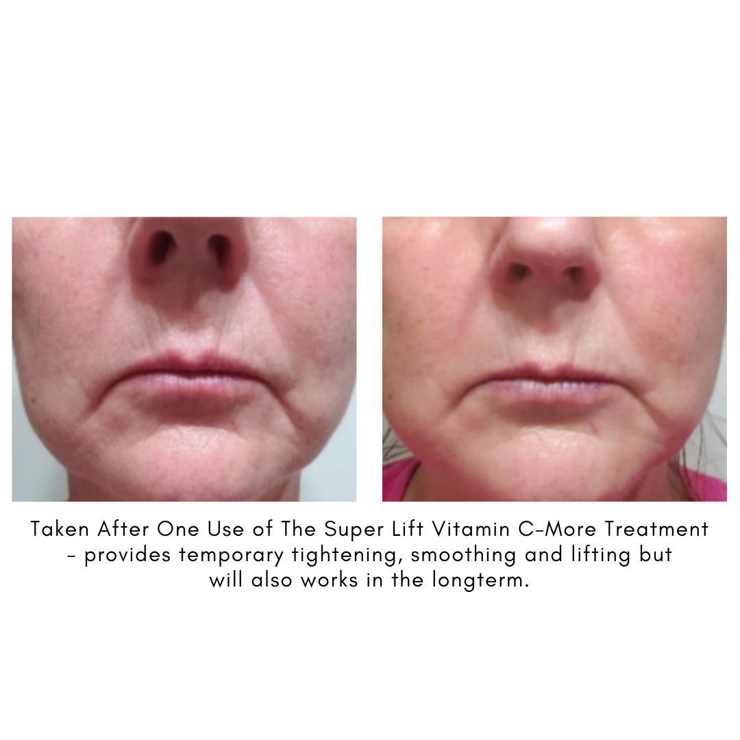 Maya Chia The Super Lift Vitamin C Results