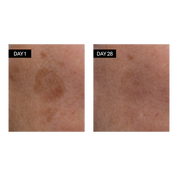 Odacité Skincare | Brightening Serum Vitamin C & E + Hyaluronic Acid Results