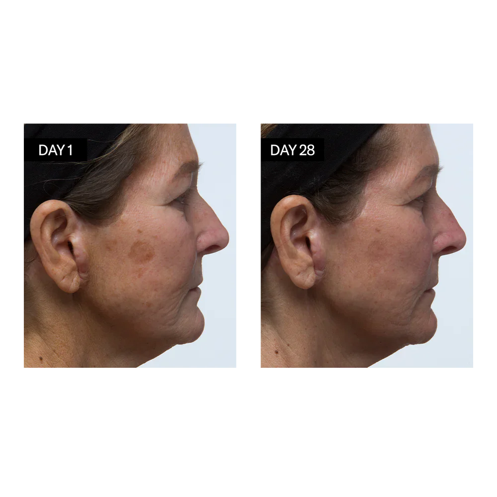 Odacité Skincare | Brightening Serum Vitamin C & E + Hyaluronic Acid Results