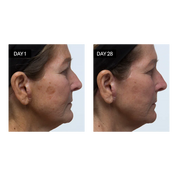 Odacité Skincare | Brightening Serum Vitamin C & E + Hyaluronic Acid Results