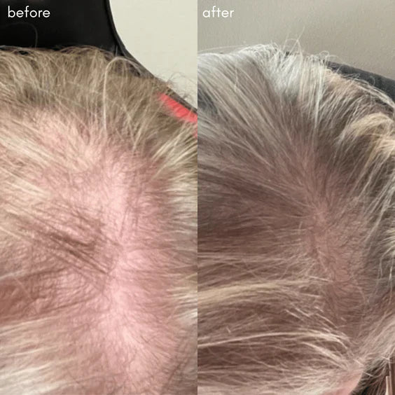 MAYA CHIA | THE POWER FOL SCALP & HAIR | advanced multi-correctional treatment