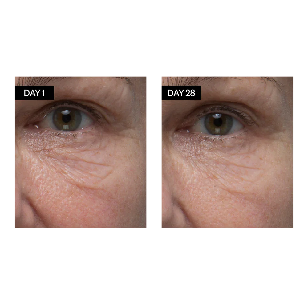 Odacité Skincare | Renewing Serum | Retinol + Hyaluronic Acid Results