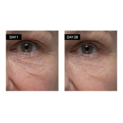 Odacité Skincare | Renewing Serum | Retinol + Hyaluronic Acid Results