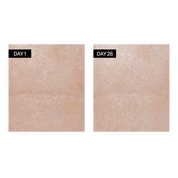 Odacité Skincare | Renewing Serum | Retinol + Hyaluronic Acid Results