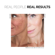 Fitglow Beauty | VITA ACTIVE SERUM Results