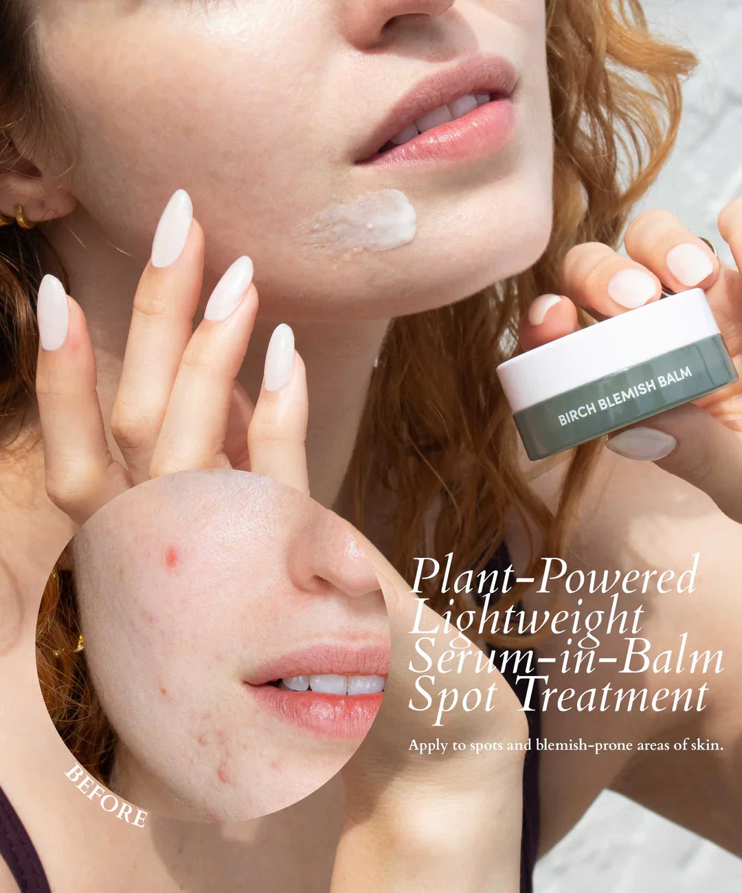 Fitglow Beauty | Birch Blemish Balm
