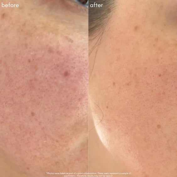 THE SUPER LIFT – Vitamin C-More Treatment