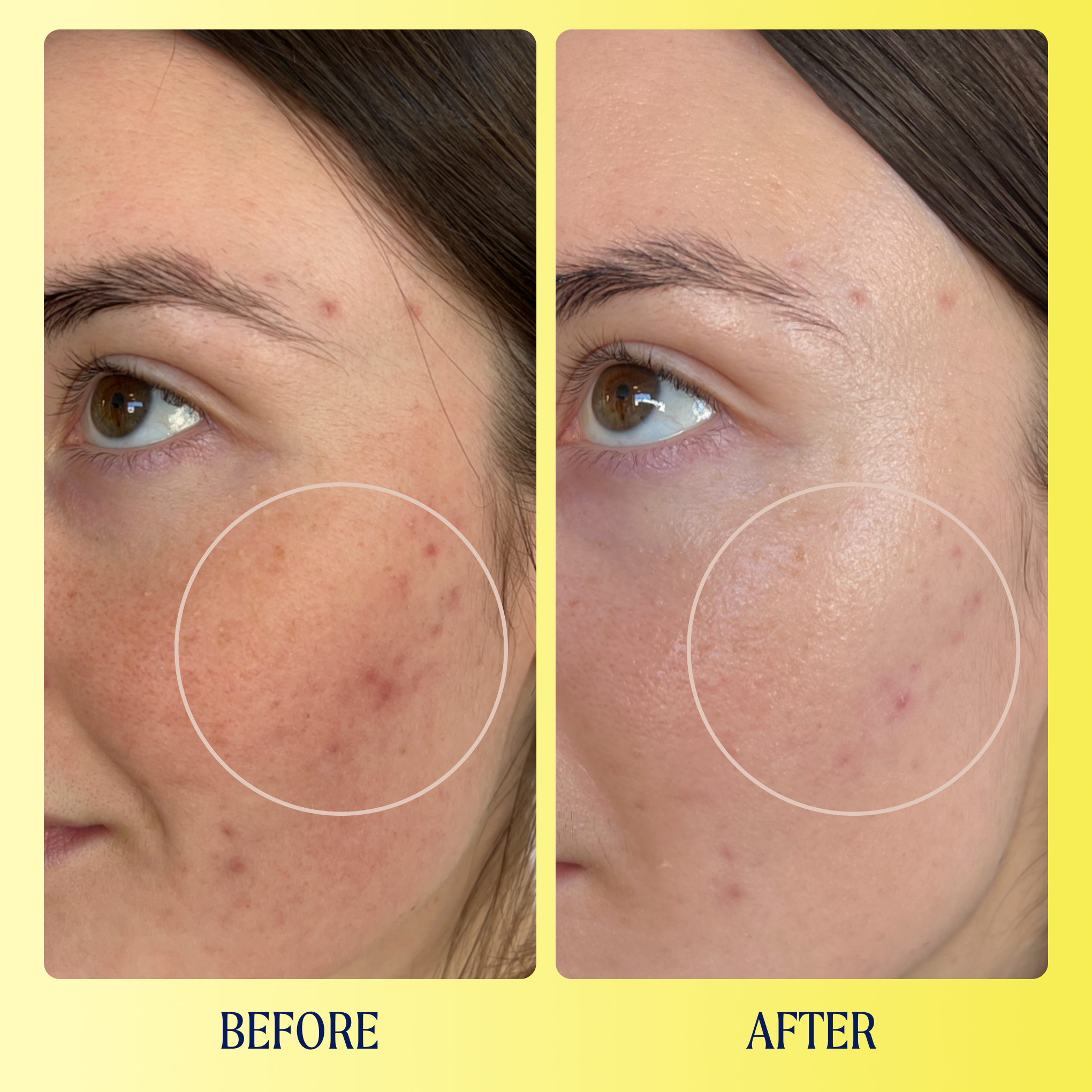 Kinship | Brightwave 10% Vitamin C + Peptide Brightening Serum