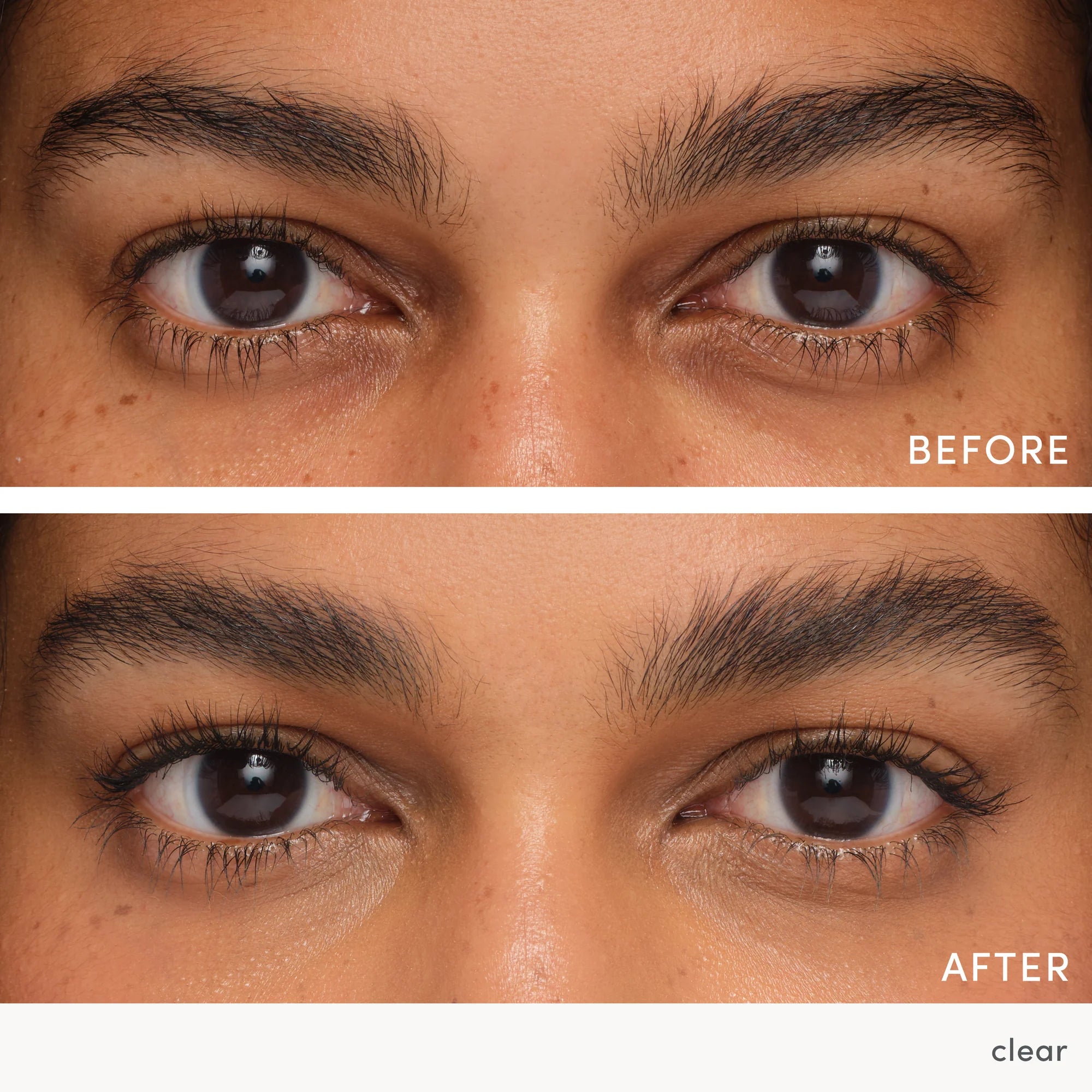 IC-GT-Before-After-Divya-Clear-Gel_2000x_51f6bddb-afda-4d65-97f5-ccbb7259845b.webp