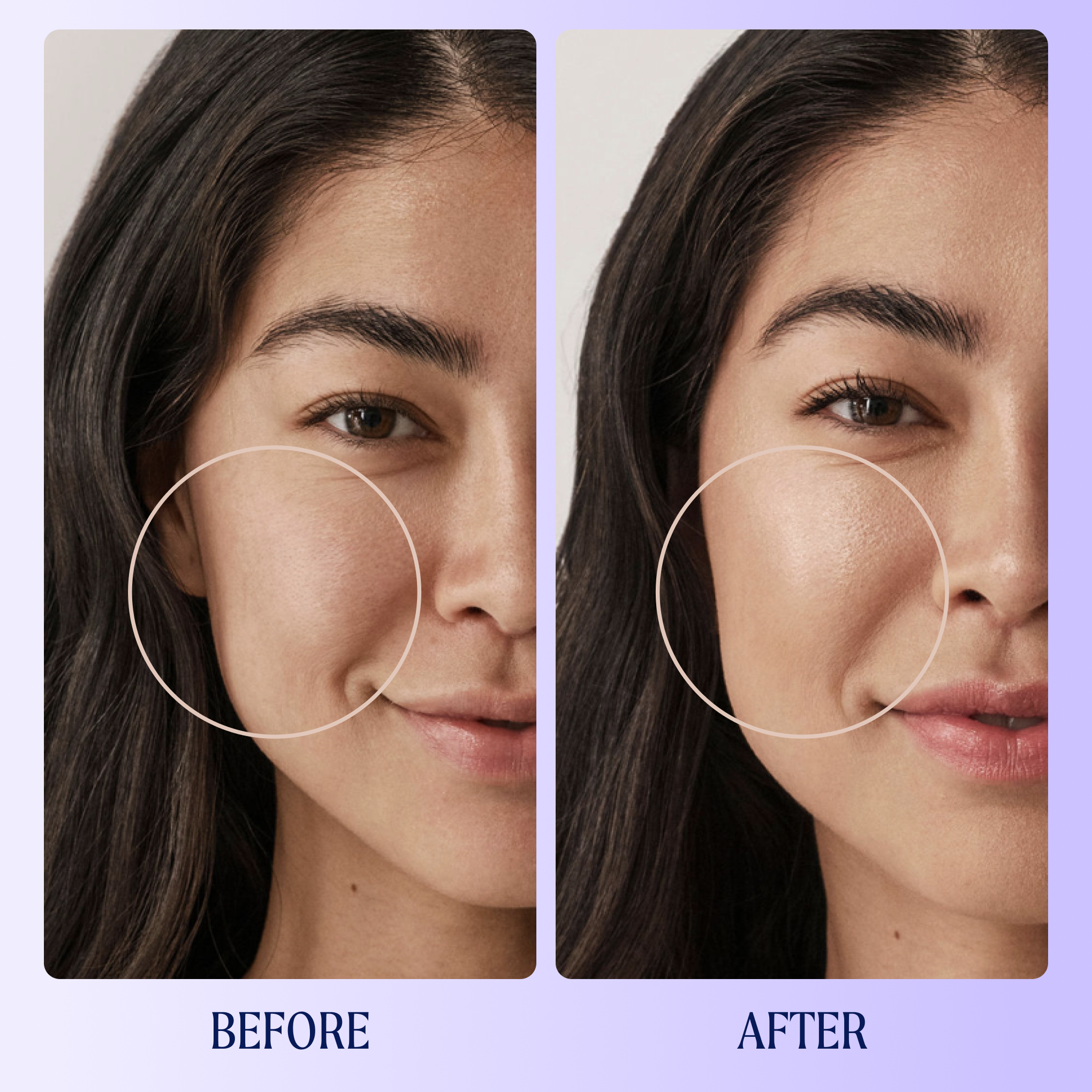 Kinship | Self Reflect Probiotic Sunscreen Zinc Oxide SPF 32