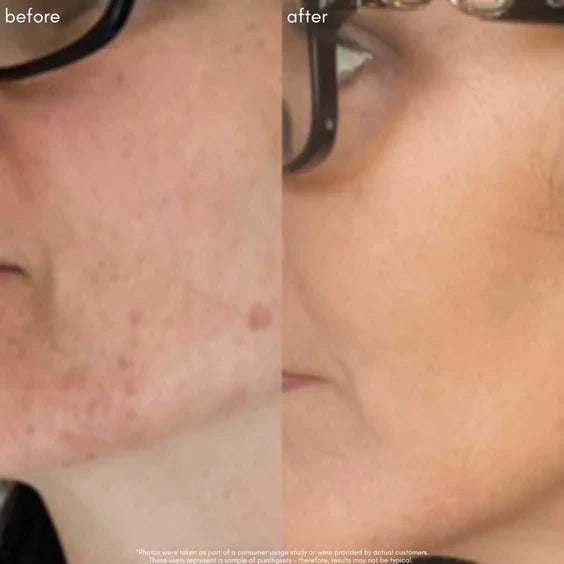 Maya Chia The Straight A Serum Advanced Gentle Retinol Srum Results